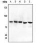 Anti-Gamma-catenin Antibody