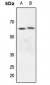 Anti-Kv1.3 Antibody