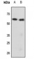 Anti-Cytokeratin 8 (pS73) Antibody