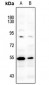 Anti-LCK (pY393) Antibody
