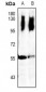 Anti-LCK Antibody