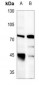 Anti-LIMK1 Antibody