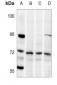 Anti-LIMK1/2 (pT508/505) Antibody