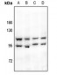 Anti-HSL Antibody