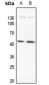 Anti-LMX1B Antibody