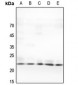 Anti-TNF beta Antibody