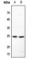 Anti-MAD2 Antibody