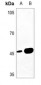 Anti-MAGEA1 Antibody