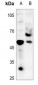 Anti-TAU (pT548) Antibody