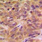 Anti-FOXO4 (pS197) Antibody