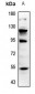 Anti-MMP12 Antibody