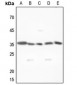 Anti-MNAT1 Antibody