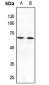 Anti-MNT Antibody