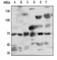 Anti-Myotubularin Antibody