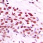 Anti-c-Myc (pT58) Antibody