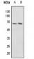 Anti-c-Myc (pT58) Antibody