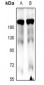 Anti-MLCK1 Antibody