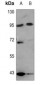 Anti-Nibrin Antibody