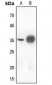 Anti-IKB alpha Antibody