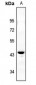 Anti-IKB beta (pS23) Antibody