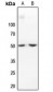 Anti-IKB beta Antibody