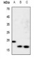 Anti-nm23-H1 Antibody