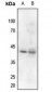 Anti-Nucleophosmin (pT199) Antibody