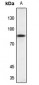 Anti-NSF Antibody