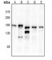 Anti-TRK B (pY516) Antibody