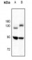 Anti-TRK B Antibody