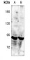 Anti-TRK C Antibody