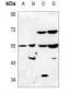 Anti-PAH Antibody