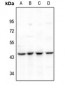 Anti-PAI2 Antibody