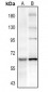 Anti-PAK3 (pS154) Antibody