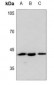 Anti-PAWR Antibody