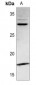 Anti-PDGFA Antibody