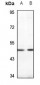 Anti-PDK1 Antibody