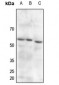 Anti-PDPK1 (pS241) Antibody