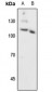Anti-Progesterone Receptor (pS294) Antibody