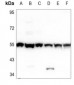 Anti-PHKG1 Antibody