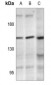 Anti-PLC gamma 2 (pY1217) Antibody