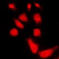 Anti-PKA C alpha/beta/gamma Antibody