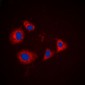 Anti-PRKAR1A Antibody