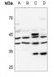 Anti-PRKAR1A Antibody