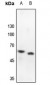 Anti-PRKAR2B Antibody