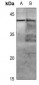 Anti-MKK1 (pT286) Antibody