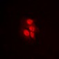 Anti-MKK1 (pT292) Antibody