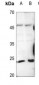 Anti-Trypsin 1 Antibody