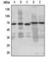 Anti-EP4 Antibody