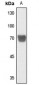 Anti-PGHS-1 Antibody